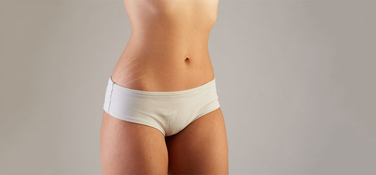 How to Get Rid of Stretch Marks?