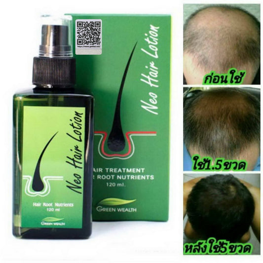 Neo Hair Lotion 120ml – Natural Herbal Hair Regrowth Treatment for Thinning Hair & Hair Loss, 100% Authentic with QR Code – Made in Thailand