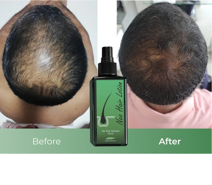Neo Hair Lotion 120ml – Natural Herbal Hair Regrowth Treatment for Thinning Hair & Hair Loss, 100% Authentic with QR Code – Made in Thailand